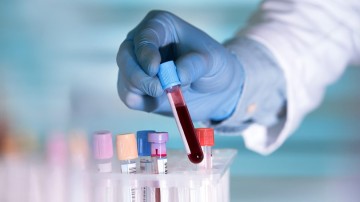 Κλειστά λόγω κινητοποιήσεων τα διαγνωστικά εργαστήρια την Παρασκευή 7 Νοεμβρίου